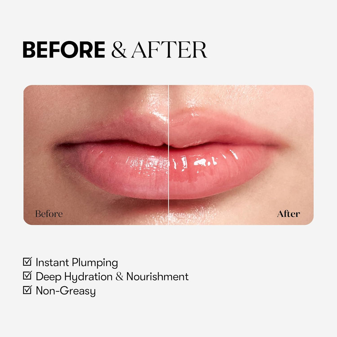Reedle Shot Lip Plumper (Beginner)