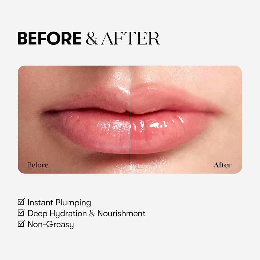Reedle Shot Lip Plumper (Beginner)