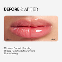 Reedle Shot Lip Plumper (Expert)