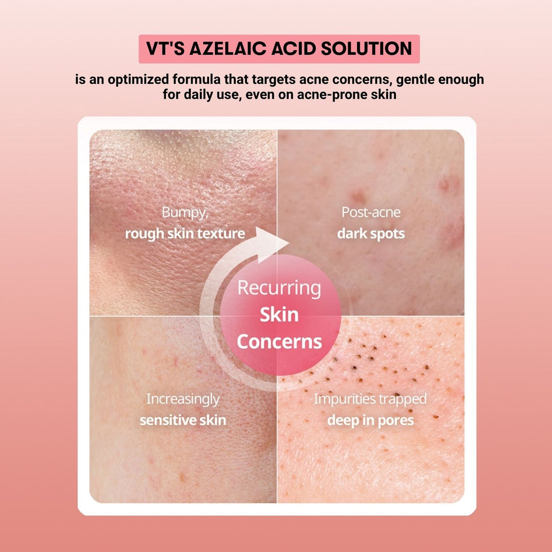 Azelaic Acid Care Capsule Cream