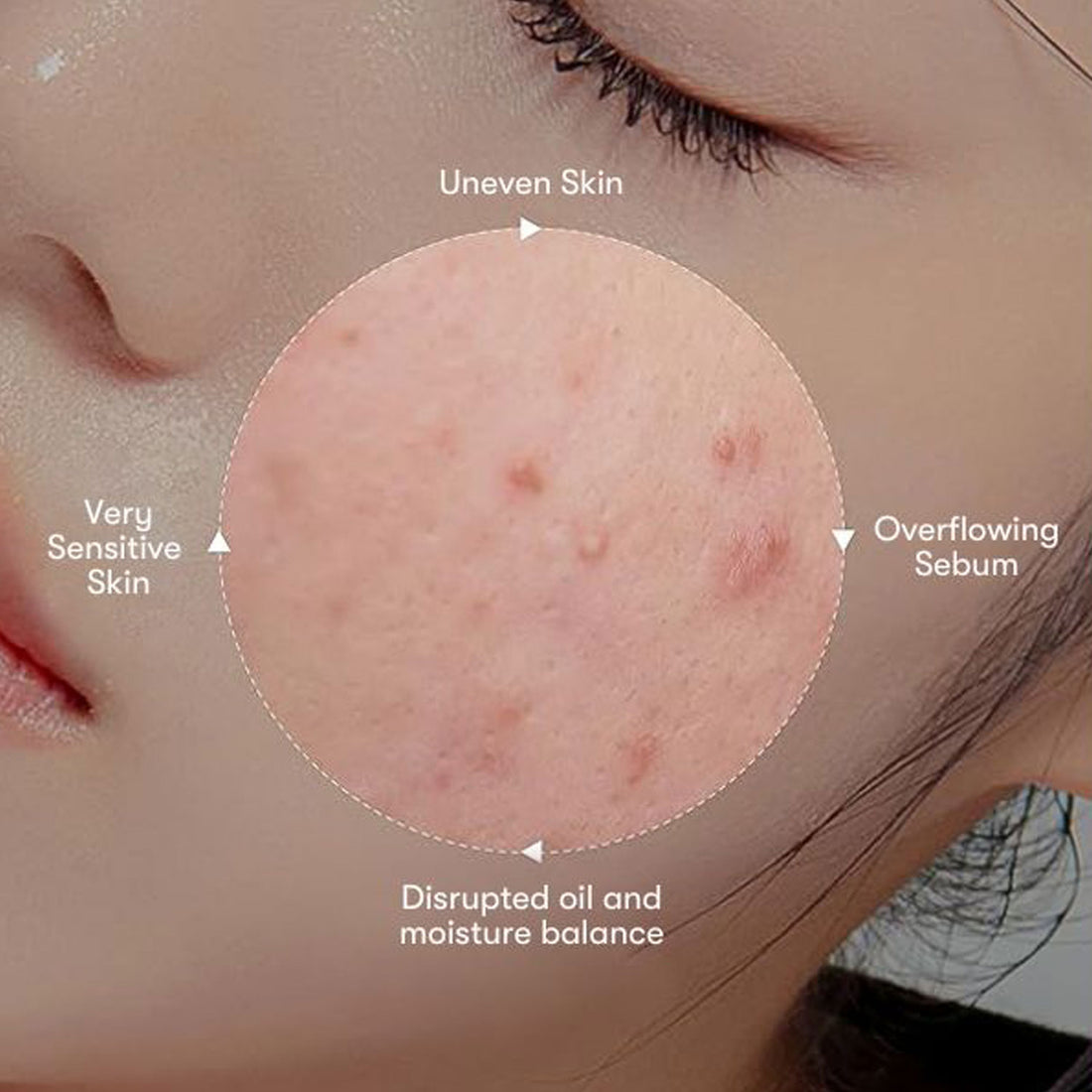 VT Azelaic Acid Sheet Mask - 30pcs
