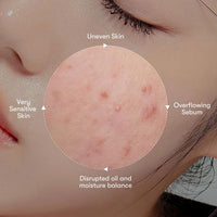 VT Azelaic Acid Sheet Mask - 30pcs