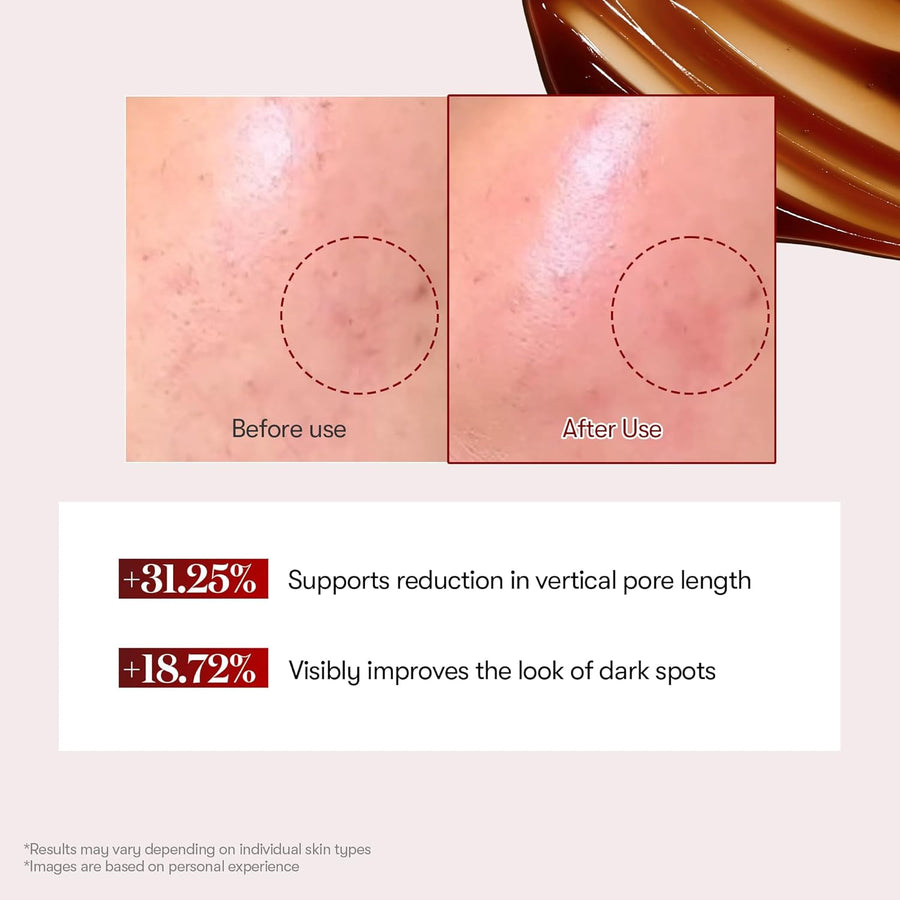 Red Booster Reedle Shot 100