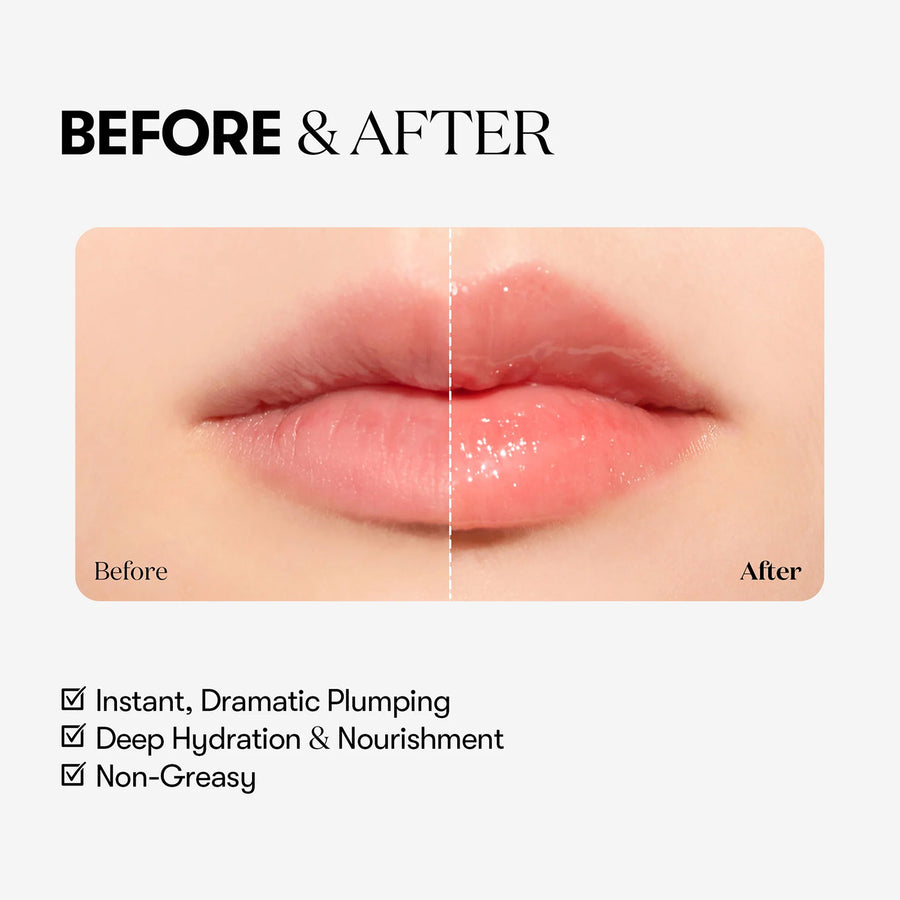 Reedle Shot Lip Plumper (Expert)