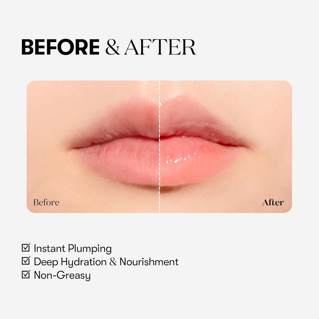Reedle Shot Lip Plumper (Beginner)