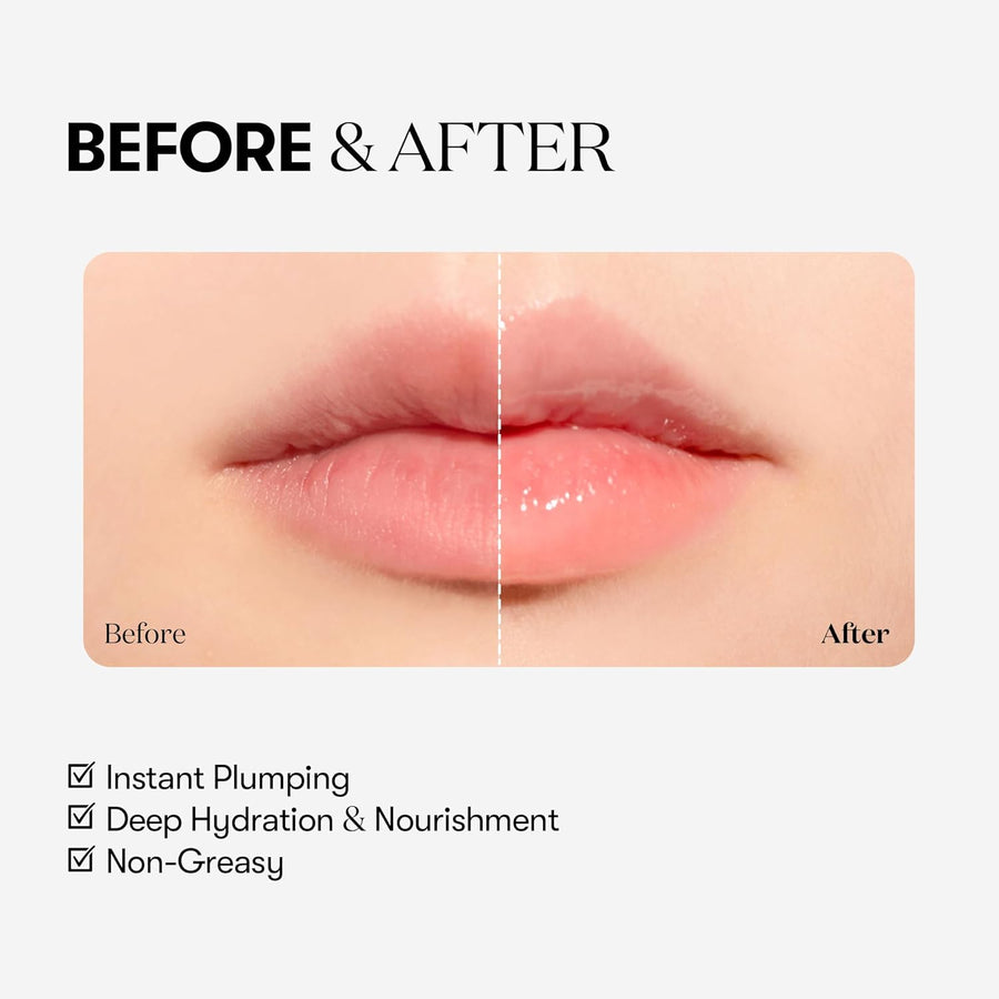 Reedle Shot Lip Plumper (Beginner)