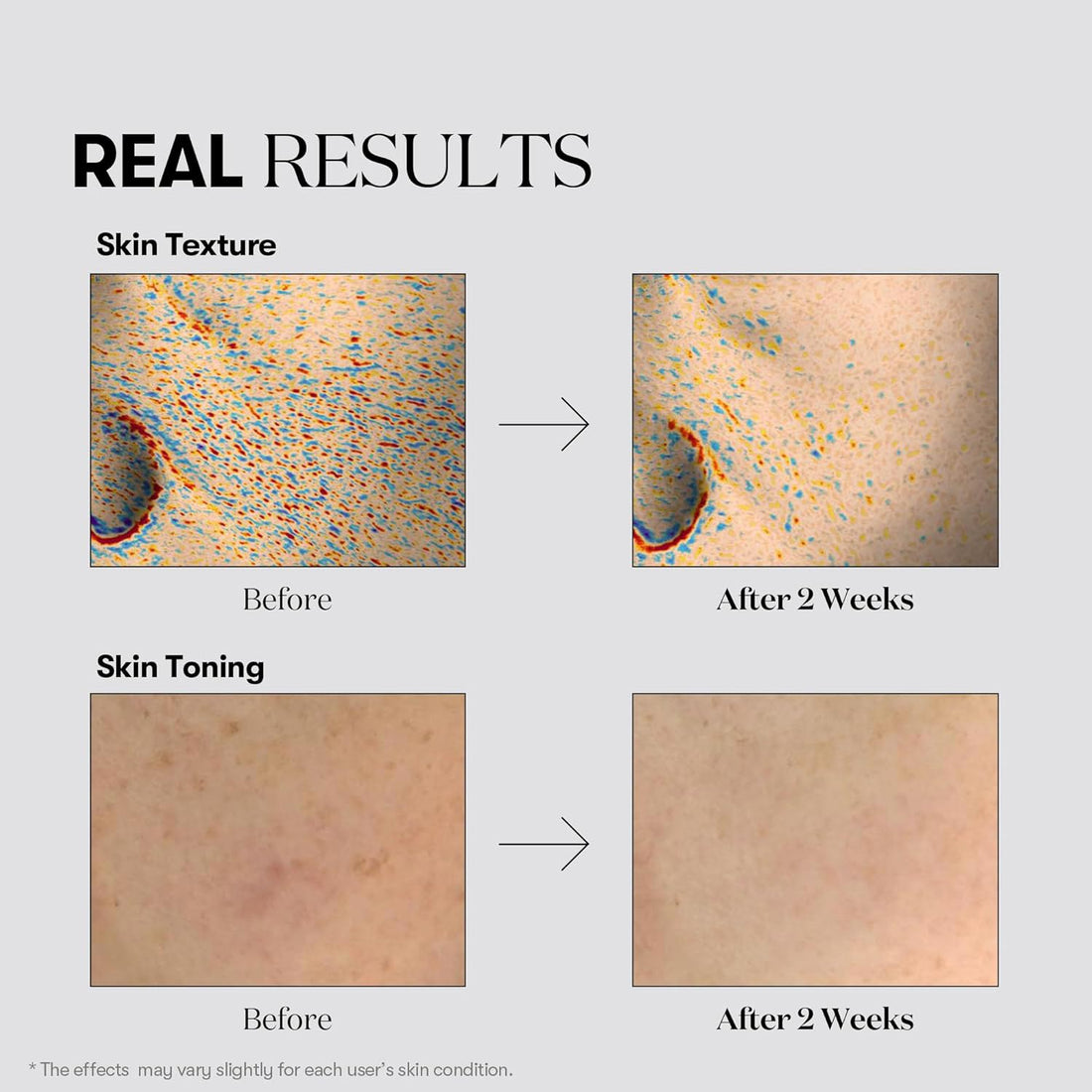 TX-Toning Daily Mask - 30pcs