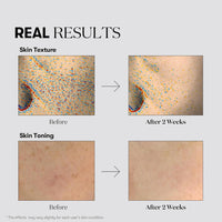 TX-Toning Daily Mask - 30pcs